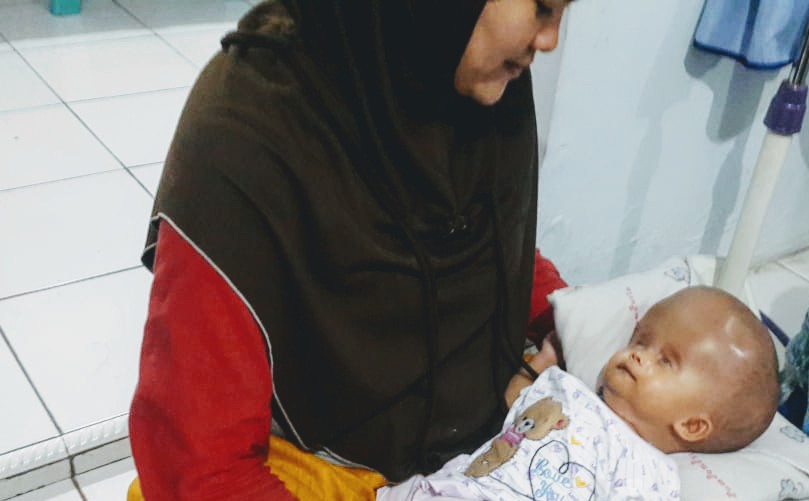 Bayi Berusia 2 Bulan Menderita Hidrosefalus, Camat Tigaraksa Bilang Begini