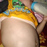 Kisah Pilu Bayi 2 Tahun di Pandeglang, Idap Tumor di Ginjal Kanan