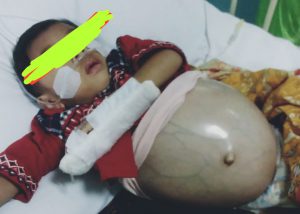 Keluarga Bocah Pengidap Wilms Tumor di Mandalawangi Pandeglang ‘Kena Prank’ Dinsos